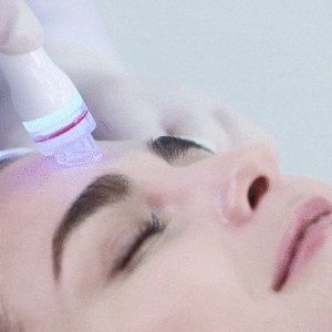  Aqua-Dermabrasion