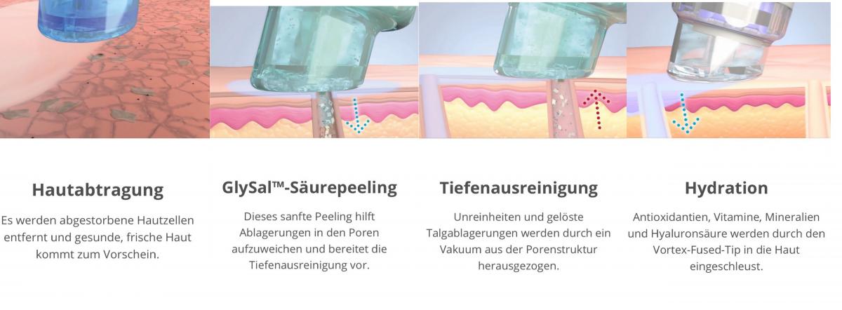 Aquapeeling