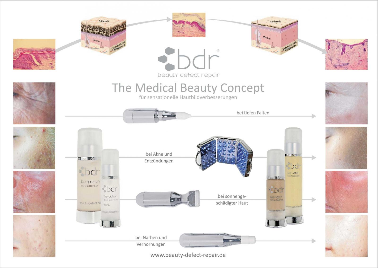 bdr® / Micro Needling